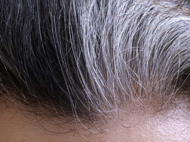 علت و درمان سفید شدن مو در کودکی و جوانی