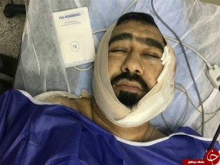 حمله به یک روحانی دیگر در ایستگاه مترو امام خمینی