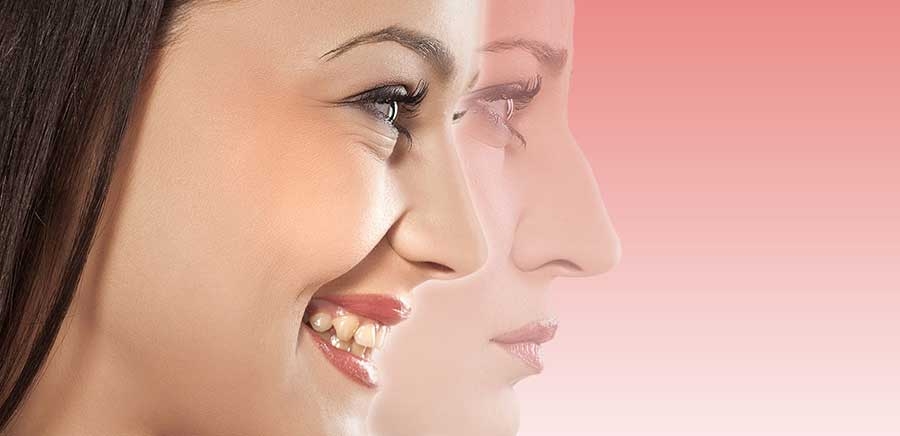 در مورد فواید و مضرات جراحی بینی چه می دانید؟