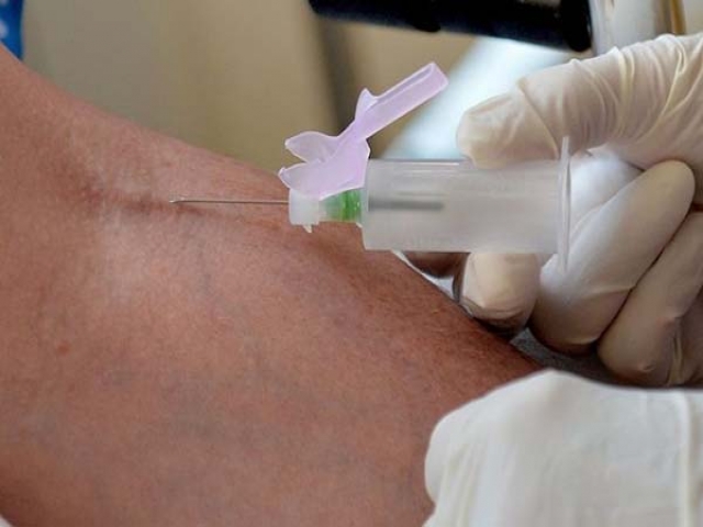 پیش بینی احتمال عود سرطان پوست با یک آزمایش ساده خون