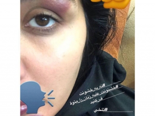 حمله فیزیکی به بازیگر زن ایرانی در خیابان