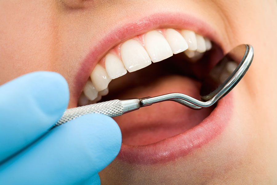 جرم دندان را به راحتی از بین ببرید
