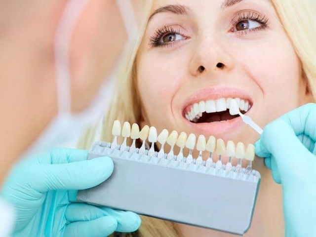 خدمات لمینت دندان در کرج