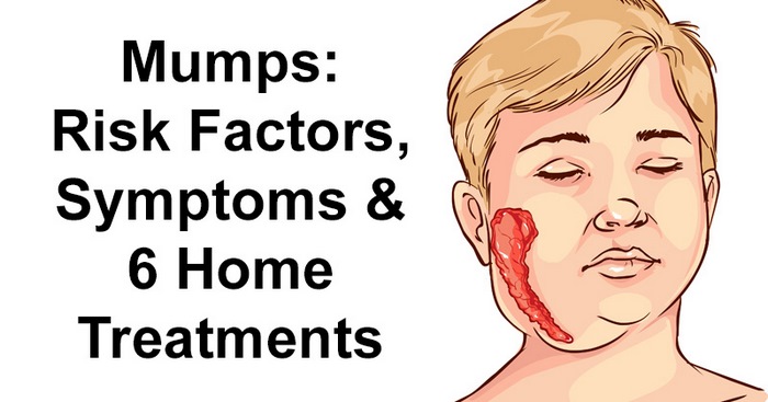 اوریون‌ چیست (علل، علائم، پیشگیری و درمان) mumps