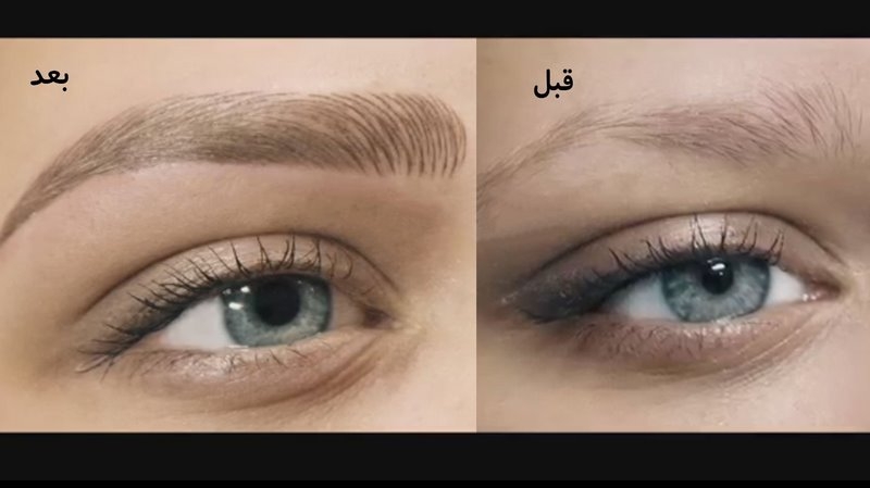 بهترین مرکز هاشور ابرو (فیبروز ابرو)