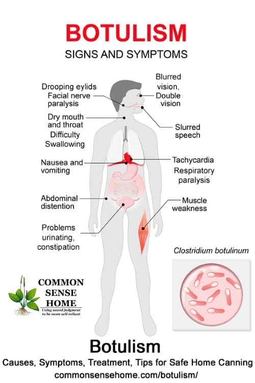 بوتولیسم چیست (علل، علائم، پیشگیری و درمان) botulism