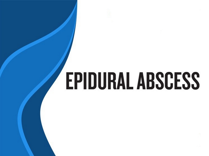 آبسه‌ مغزی‌ چیست (اپی‌دورال )(علل، علائم، پیشگیری و درمان) brain or epidural abscess