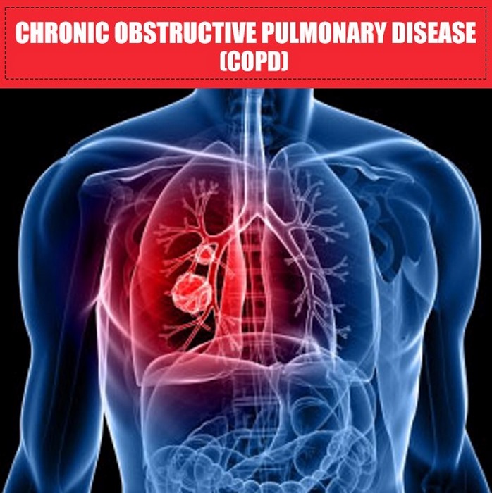 انسداد ریوی‌ مزمن چیست (علل، علائم، پیشگیری و درمان) COPD