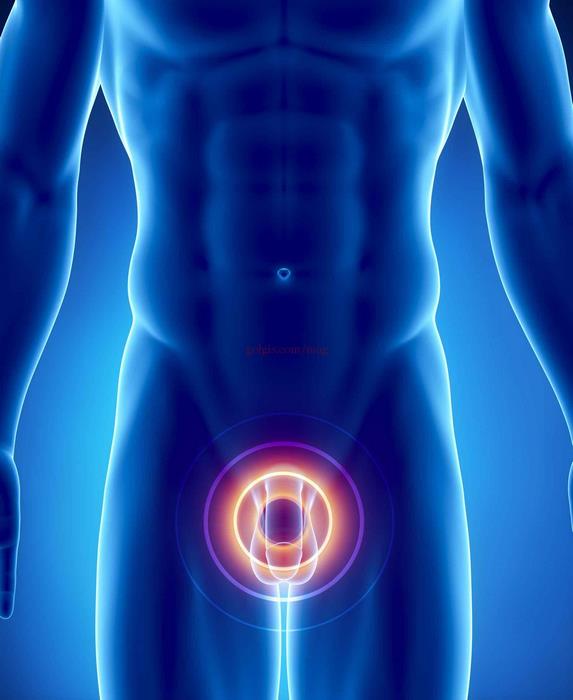 balanitis
