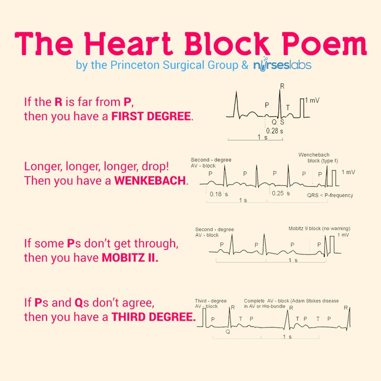 بلوک‌ قلبی‌ چیست (علل، علائم، پیشگیری و درمان) heart block