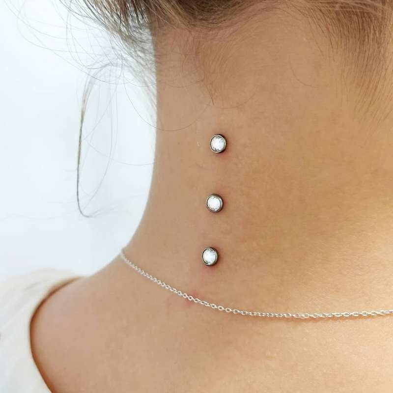 میکرودرمال چیست و چگونه انجام میشود؟