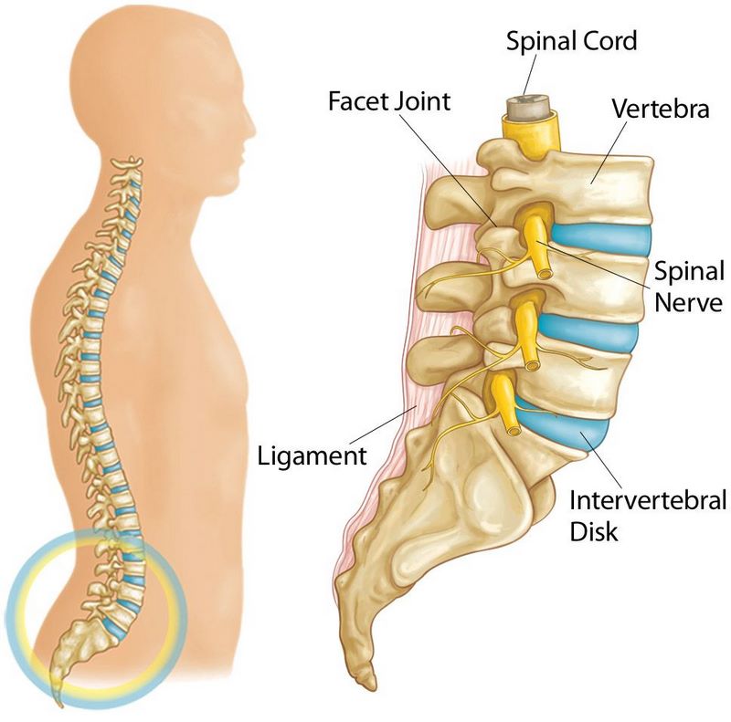 پارگی و بیرون زدگی دیسک بین مهره ای چیست (علل، علائم، پیشگیری و درمان) disk ruptured پارگی و بیرون زدگی دیسک بین مهره ای چیست (علل، علائم، پیشگیری و درمان) disk ruptured