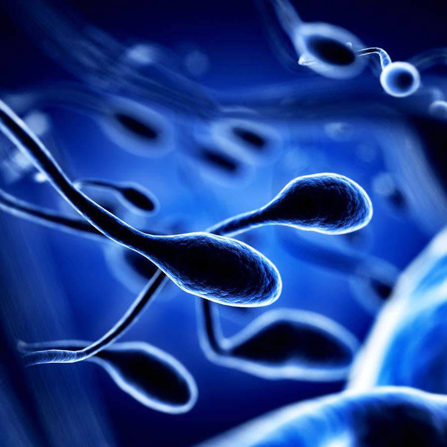 شیوع ناباروری مردان ایران بالاتر از آمارهای جهانی - The prevalence of male infertility in Iran is higher than worldwide statistics