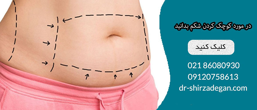 پرطرفدارترین عمل های زیبایی ایران