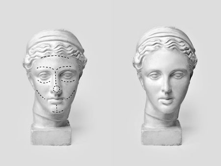 عمل بینی طبیعی