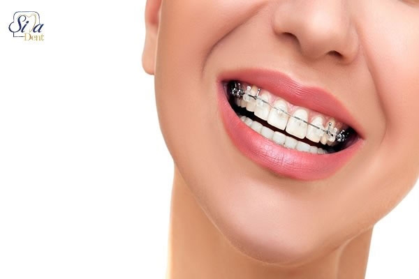 ارتودنسی ، ایمپلنت و اصلاح طرح لبخند
