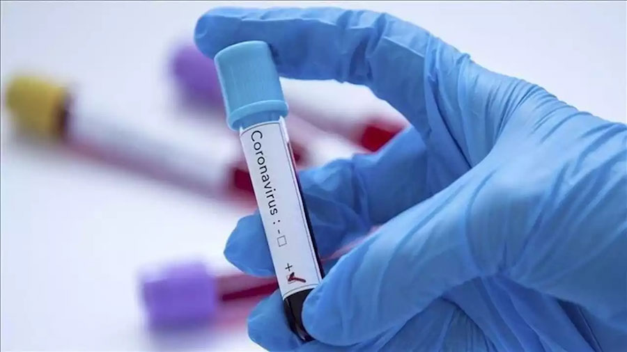 تعداد بیماران مبتلا به ویروس کرونا بیشتر است - There are more patients with coronavirus تعداد بیماران مبتلا به ویروس کرونا بیشتر است - There are more patients with coronavirus