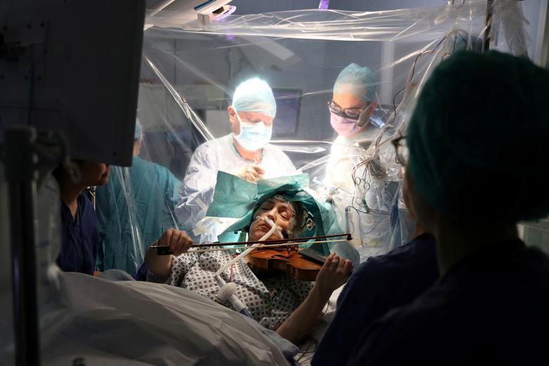 عمل جراحی خارج کردن یک تومور مغزی در بیمارستان کینگز کالج لندن. بیمار زیرعمل که بی حسی موضعی دارد، در حال نواختن ویولون است