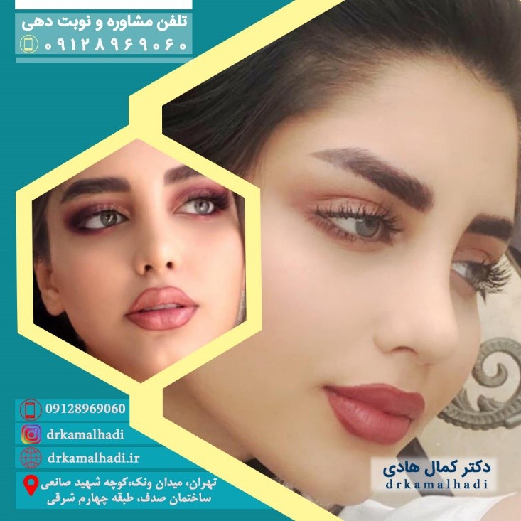 بهترین مدل جراحی زیبایی بینی