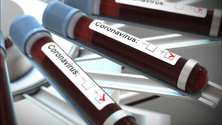 2800 کیت تشخیص ویروس کرونا وارد کشور شد - 2800 Coronavirus detection kits arrived in the country