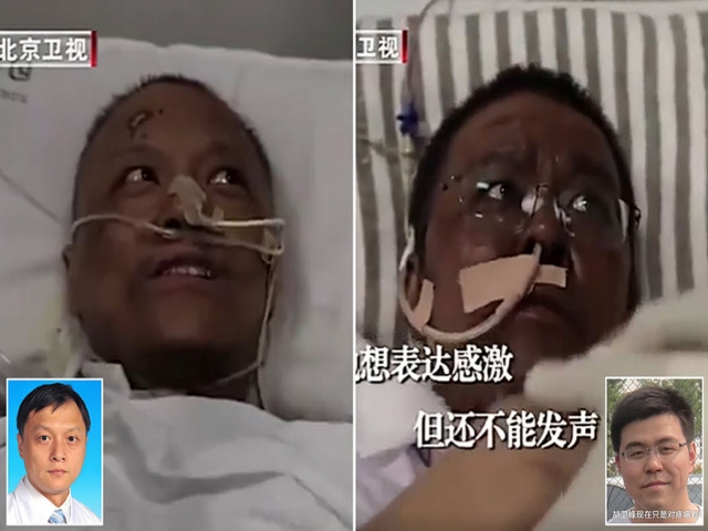 پوست 2 پزشک چینی مبتلا به "کووید-19" سیاه شد