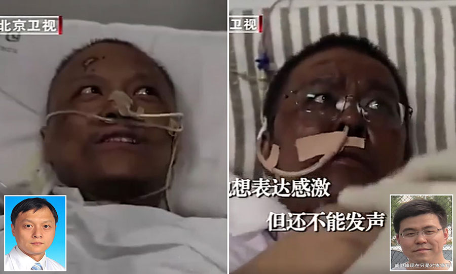 پوست 2 پزشک چینی مبتلا به "کووید-19" سیاه شد - The skin of two Chinese doctors with Covid-19 turned black