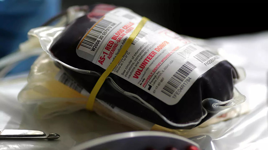 ترس کاذب بهبودیافتگان ویروس کرونا از اهدای پلاسما - False fears of Coronavirus recovered patients from plasma donation ترس کاذب بهبودیافتگان ویروس کرونا از اهدای پلاسما - False fears of Coronavirus recovered patients from plasma donation
